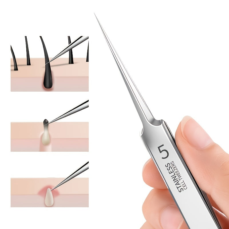 "Blackhead remover tool" "Acne treatment tools" "High-precision tweezers" "Stainless steel tweezers" "Blackhead extraction tool" "Professional facial tools""Health""Acne"