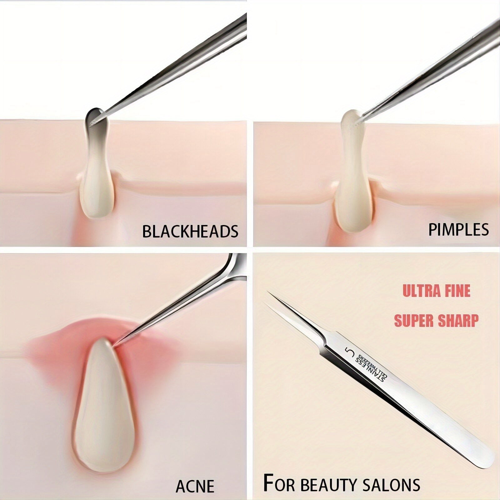 "Blackhead remover tool" "Acne treatment tools" "High-precision tweezers" "Stainless steel tweezers" "Blackhead extraction tool" "Professional facial tools""Health""Acne"